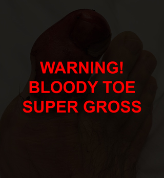 atm-2015-toe-overlay